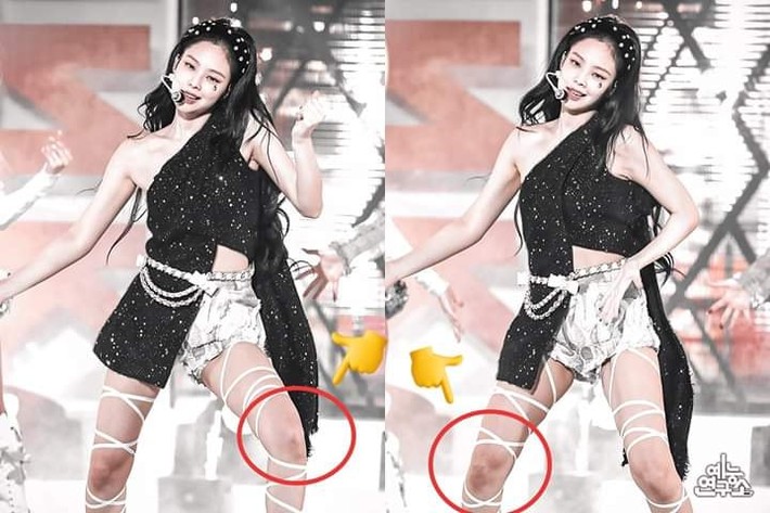 Giữa làn sóng bị chỉ trích vì lười biếng, Jennie (BLACKPINK) khiến fan xót xa khi xuất hiện với hình ảnh đầu gối bầm tím - Ảnh 1.