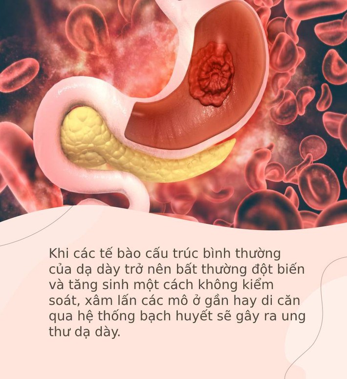 Hai căn bệnh cực kỳ phổ biến nhưng rất dễ phát triển thành ung thư, bạn cần ngăn chặn ngay từ bây giờ  - Ảnh 4.