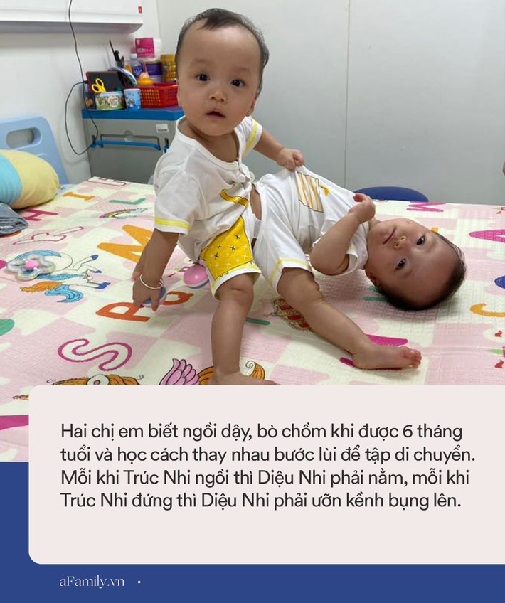 Hành trình tách rời “định mệnh” của Trúc Nhi - Diệu Nhi và hy vọng lớn về một tương lai chị em ta “dung dăng dung dẻ” - Ảnh 3.