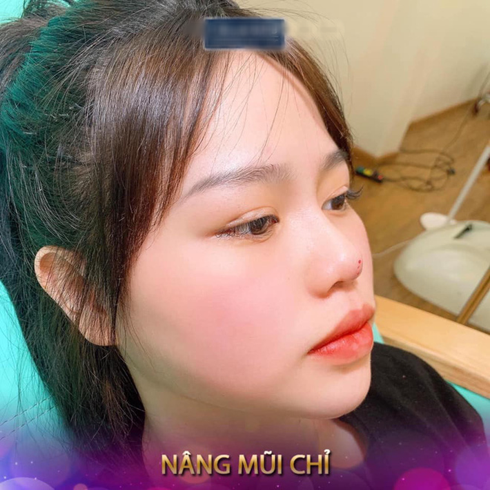 Vừa bị một spa lấy ảnh không xin phép để quảng cáo dịch vụ nâng mũi, hot girl Huỳnh Anh đăng ngay story chứng minh mình 