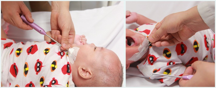 Em bé quê ở Yên Bái là một trong những trường hợp hiện đang được điều trị tại bệnh viện Nhi Trung ương