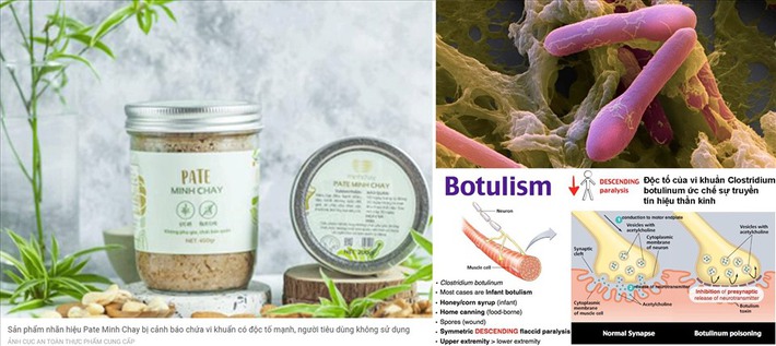 Chuyên gia đánh giá vi khuẩn Clostridium botulinum liên quan đến thực phẩm pate Minh Chay là chất độc thần kinh cực mạnh - Ảnh 2.