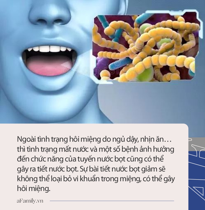 4 cách khử mùi hôi miệng siêu hiệu quả trong 4 hoàn cảnh: Vừa ngủ dậy, khi bạn lo lắng, lúc ăn no hoặc đói bụng - Ảnh 2.