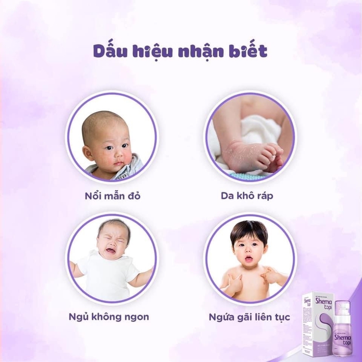 Con quấy khóc cả đêm, dỗ mãi không nín, sáng hôm sau mẹ thay bỉm mới thấy hối hận - Ảnh 2.