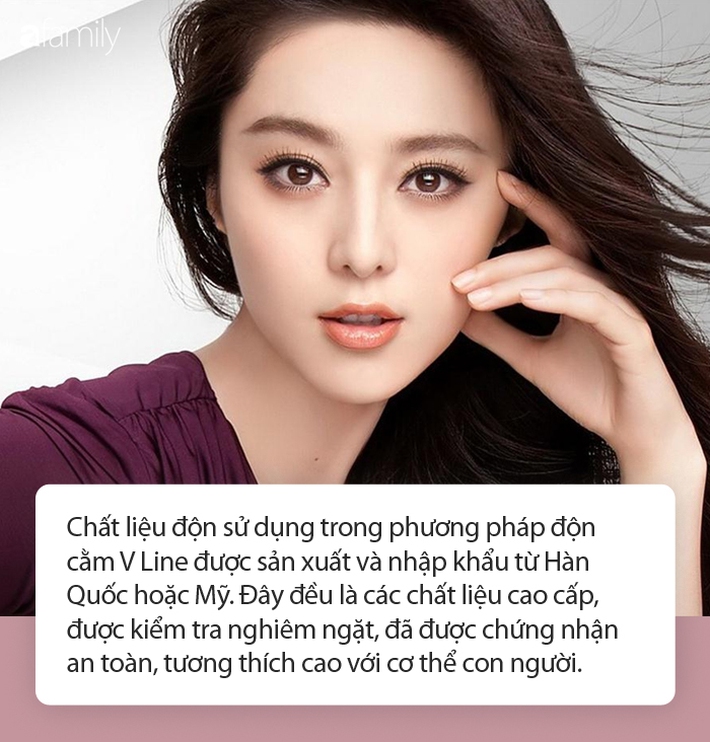 Phẫu thuật độn cằm V-line: Chuyên gia chia sẻ từ A đến Z - Ảnh 3.