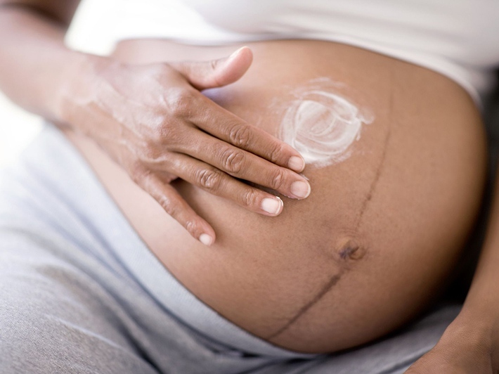 Mẹ bầu 31 tuần bị ngứa da và xém sảy thai, không phải tất cả mọi khó chịu đều phải chịu đựng - Ảnh 3.