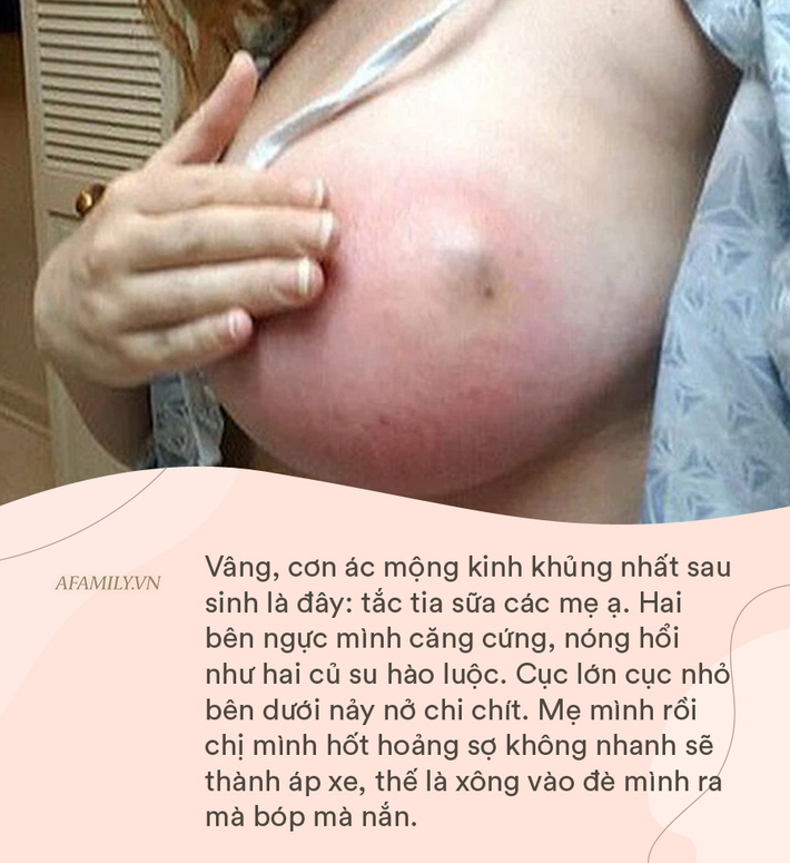 Tưởng đau đẻ đã vã lắm rồi, đến khi trải nghiệm cơn ác mộng kinh khủng nhất sau sinh, mẹ Hà Nội mới biết mình đã nghĩ sai quá sai - Ảnh 5.