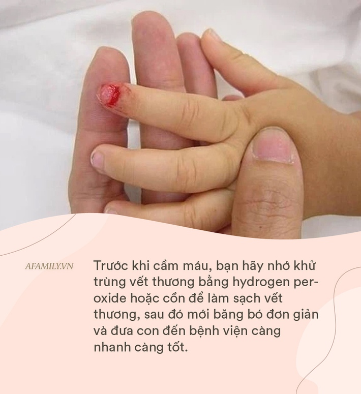 Thấy con bị kẹt tay vào quạt chảy nhiều máu, bà mẹ làm ngay 1 việc được bác sĩ khen ngợi hết lời - Ảnh 2.