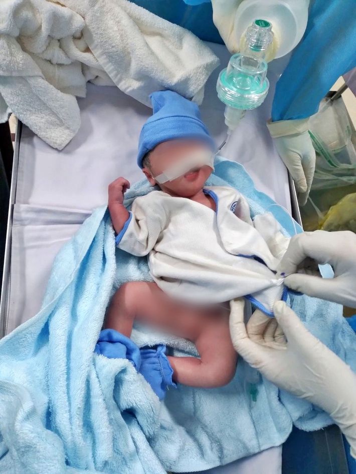Mẹ nhiễm COVID-19 nằm hồi sức cấp cứu, bé trai 2kg được bác sĩ 2 bệnh viện Sài Gòn giúp chào đời an toàn - Ảnh 1.