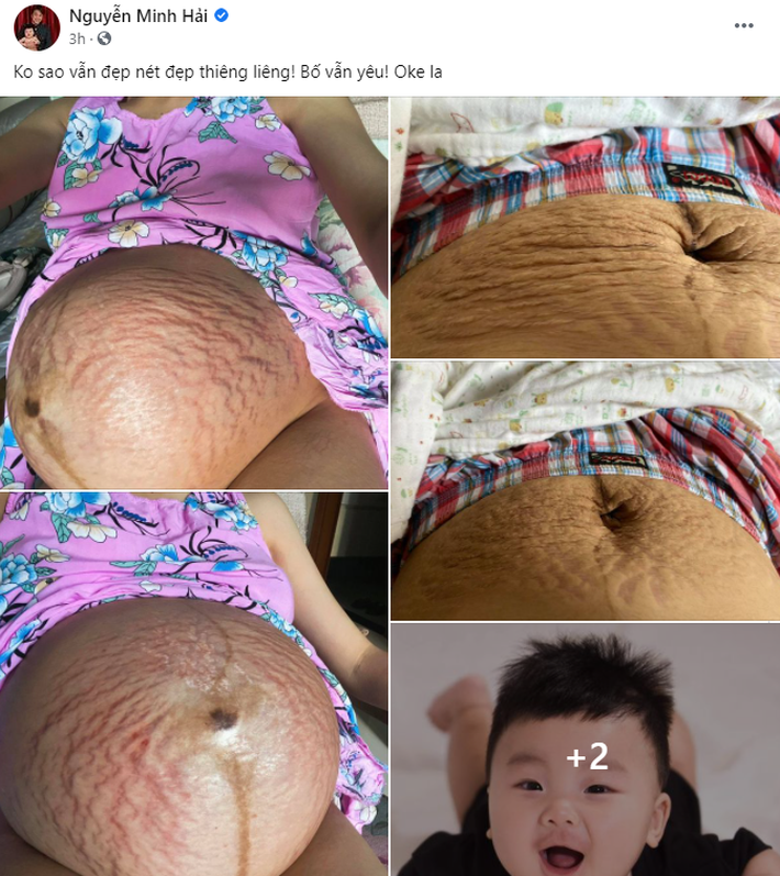 Ông xã Hòa Minzy có chia sẻ gây chú ý sau khi vợ công khai hình ảnh bụng rạn hậu sinh con - Ảnh 2.