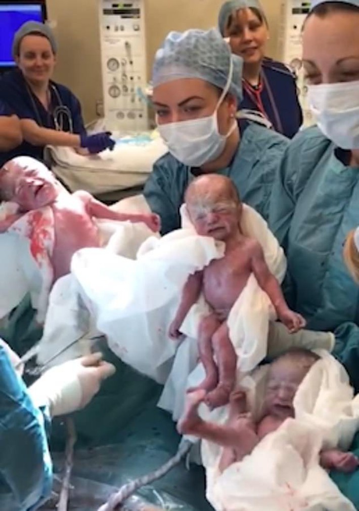 Dù đã được báo trước nhưng bà mẹ vẫn không thể tin vào mắt mình khi bác sĩ đón một đàn con trong bụng cô chào đời - Ảnh 2.
