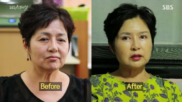 Người phụ nữ 57 tuổi lột xác hoàn toàn sau PTTM nhưng phản ứng trái ngược của người chồng mới gây phẫn nộ - Ảnh 1. Người phụ nữ 57 tuổi lột xác hoàn toàn sau PTTM nhưng phản ứng trái ngược của người chồng mới gây phẫn nộ - Ảnh 1.