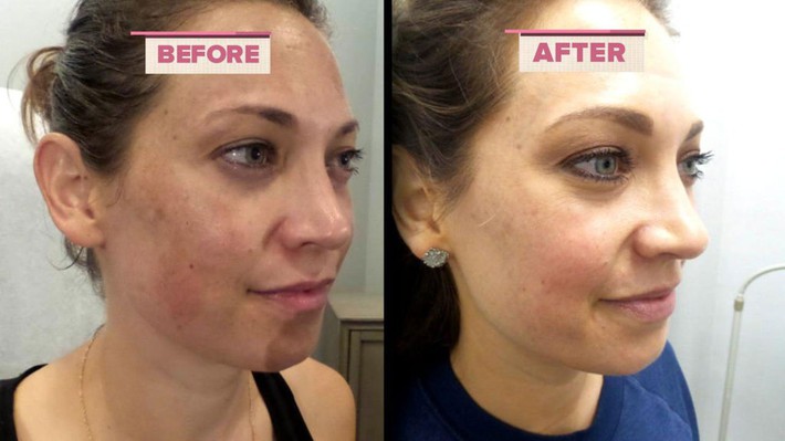 ginger-zee-melasma-2-1024x576 (1) ginger-zee-melasma-2-1024x576 (1)