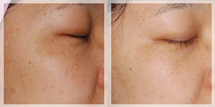serum-tri-nam-lam-khoe-da-murad-advanced-active-radiance-serum-2 serum-tri-nam-lam-khoe-da-murad-advanced-active-radiance-serum-2