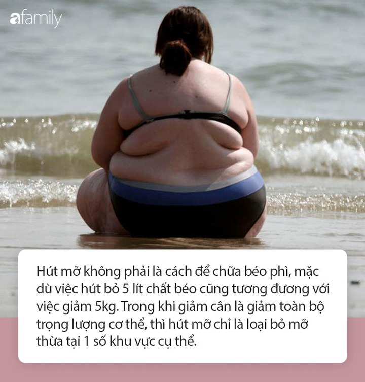 Hút mỡ có hại hay có lợi, đâu là những điều kiện cần thiết khi tiến hành hút mỡ - Ảnh 1.