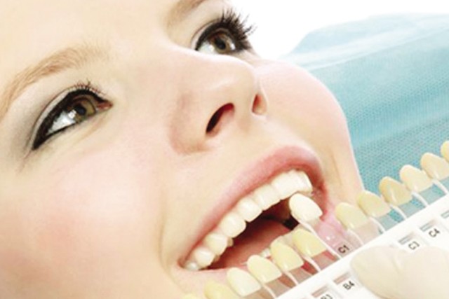 Việc tẩy trắng răng buộc phải thực hiện tại các phòng nha khoa, các bệnh viện có chuyên khoa răng- hàm- mặt, có sự tư vấn kỹ càng. Ảnh minh họa
