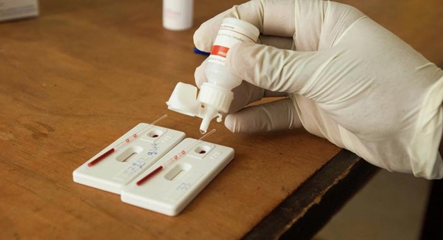 Liệu loại thuốc mới có thể triệt hạ HIV một cách hoàn toàn?