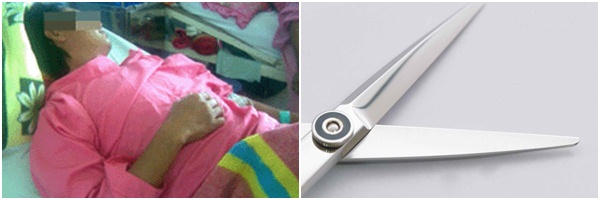 Cắt phăng &ldquo;của qu&yacute;&rdquo; khiến chồng cũ qua đời