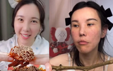 Mặt cô gái biến dạng sau 2 năm làm mukbang