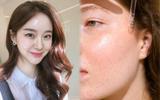 Phụ nữ ngoài 30 đua nhau dùng retinol chống lão hóa: Bác sĩ da liễu tiết lộ chỉ ra sai lầm nhiều người mắc