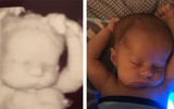 Dân mạng phấn khích với hình ảnh bé 3 tuần tuổi có tư thế ngủ y hệt lúc nằm trong bụng mẹ
