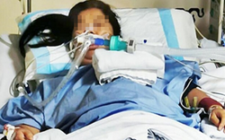 Người phụ nữ bị xuất huyết não, hôn mê sau khi uống canh đậu xanh liên tục trong 3 ngày