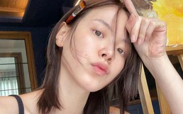 Bác sĩ cho biết 4 cách loại bỏ đốm nâu tại nhà: Không khó để áp dụng, còn nâng cấp da đẹp toàn diện