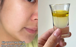 Không giúp đẹp sau một đêm, nhưng thói quen này khiến làn da của tôi ổn định hơn từng ngày