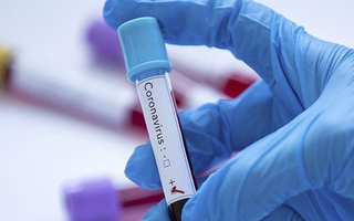 Phát hiện phân tử có thể ức chế virus SARS-CoV-2