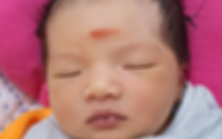 Cấp cứu tối khẩn, cứu thai nhi bị sa dây rau
