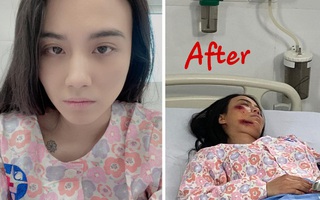 Linh Miu "xả vai nhập viện" sau phát ngôn gây phẫn nộ về cố nghệ sĩ Chí Tài khiến dân mạng nặng lời chỉ trích lần 3