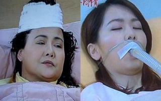 Đỉnh cao phim Hoa ngữ: Băng bó vết thương như trò trẻ con, ống thở được nối ở cằm khiến khán giả bị sốc 
