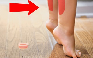 Cứ ngỡ con đi nhón chân là chuyện bình thường, ai ngờ đây lại là dấu hiệu cảnh báo bệnh nguy hiểm