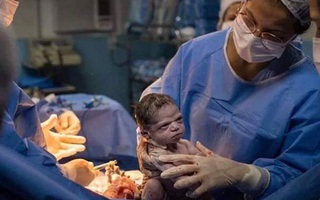 Truy tìm danh tính em bé vừa chào đời đã "lườm xắt xéo" bác sĩ gây bão MXH và tiết lộ bất ngờ từ nhiếp ảnh gia