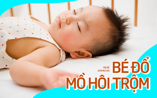 Bác sĩ giải đáp thực hư việc trẻ đổ mồ hôi nhiều trong khi ngủ có phải do thiếu canxi? 