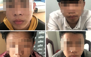 Thiếu nữ 15 tuổi bị nhóm bạn thiếu niên hiếp dâm tập thể ở bãi cỏ ven đường