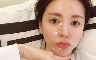 Cục mụn vô duyên có thể ghé thăm bất cứ lúc nào, ghim sẵn độc chiêu trị mụn 4 bước bác sĩ da liễu mách cho ngay nào các nàng ơi