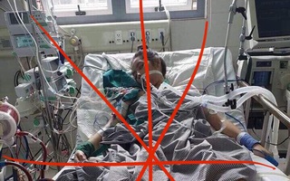 Bộ Y tế lên tiếng về bức ảnh nữ bệnh nhân nguy kịch được cho là cô gái mắc Covid-19