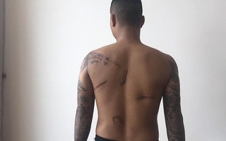 Nghi vấn đàn em Đường Dương truy sát nam thanh niên lúc nửa đêm rồi vứt xuống hố