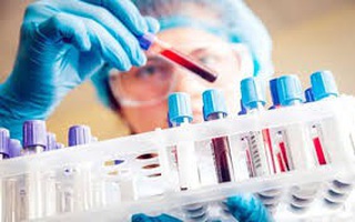 Bộ Y tế thông tin về kết quả nuôi cấy virus của các ca mắc COVID-19 tái dương tính