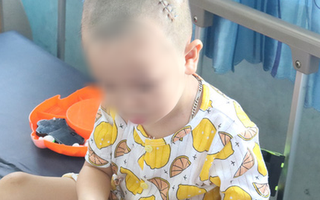 Ngã từ trên gác cao 3m xuống đất, bé trai bị lõm sọ