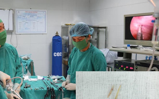 Trẻ đau bụng nhập viện, gia đình tá hỏa khi bác sĩ gắp ra tăm, xương trong dạ dày