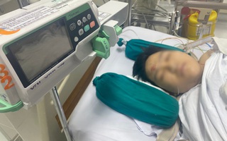 Thông tin về tình trạng 8 học sinh bị cây phượng đè phải cấp cứu tại BV Nhi Đồng 2: 4 trường hợp chấn thương nặng