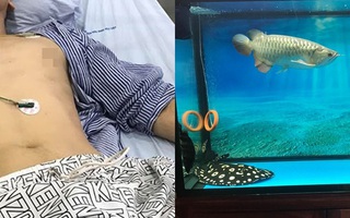 Cho chồng nuôi loại cá cảnh phổ biến này, cô vợ hốt hoảng đưa đi cấp cứu vì bị nọc độc đâm vào người