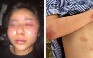 Vụ gã đàn ông xăm trổ "tra tấn" cô gái suốt 2 tiếng đồng hồ trong nhà: Công an lên tiếng