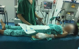Thiếu niên bị nát tay, vỡ nhãn cầu cả 2 mắt sau tiếng nổ lớn