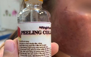 Trị nám bằng dưỡng chất mua trên mạng, da mặt cô gái trẻ đen sạm