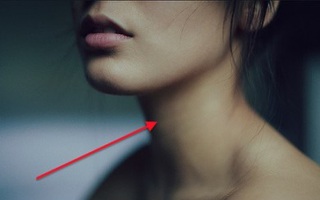 Đây là 4 kiểu người có nguy cơ cao mắc ung thư tuyến giáp nhất: Nếu cũng thuộc nhóm người này, bạn nên đi khám càng sớm càng tốt