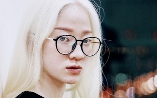Cô gái bạch tạng ở Hà Nội từng khiến mẹ khóc ròng khi chào đời với nỗi sợ tương lai "đoản mệnh" và cuộc sống phải trốn ánh nắng mặt trời