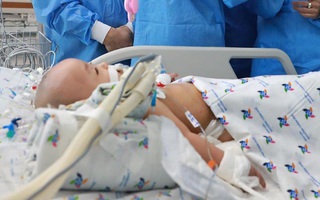 Một tuần sau ca đại phẫu tách cặp song sinh dính liền: Bé Diệu Nhi đã được cai máy thở và liên tục nhoẻn miệng cười